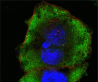 IF - FER Antibody AO1125a